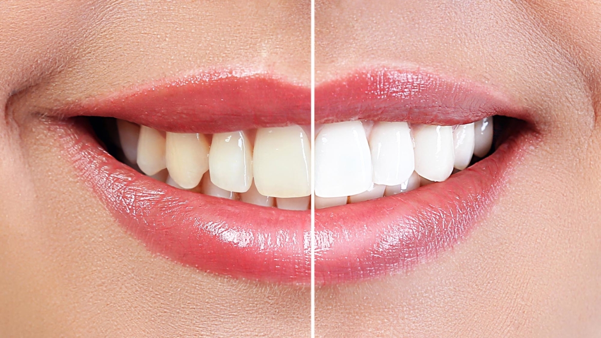 Cosmetic Dentistry