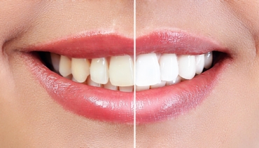 Cosmetic Dentistry